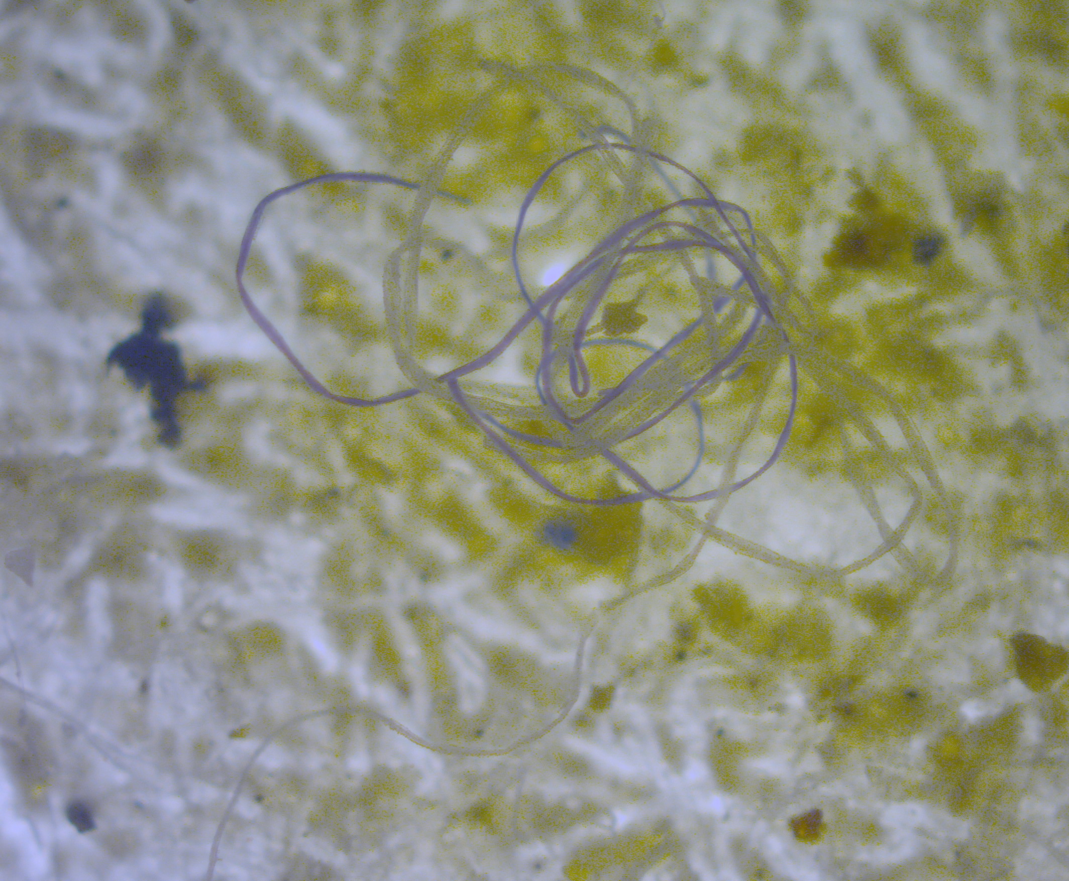 مكونات ميكروبلاستيكية في البحر